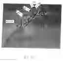 Fig. 06 - ANASTOMOTIC DEVICE PROMOTING TISSUE NECROSIS