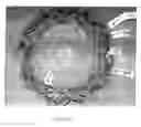 Fig. 19 - ANASTOMOTIC DEVICE PROMOTING TISSUE NECROSIS