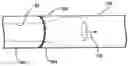 Fig. 01 - Transconduit perfusion catheter