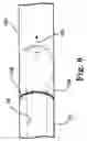 Fig. 05 - Transconduit perfusion catheter
