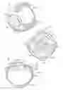 Fig. 02 - System and method for making incisions for scleral eye implants