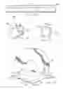 Fig. 12 - System and method for making incisions for scleral eye implants