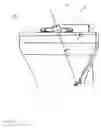 Fig. 05 - Retrograde excision system and apparatus