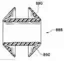 Fig. 01 - DEVICES AND METHODS FOR MAINTAINING COLLATERAL CHANNELS IN TISSUE