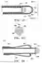 Fig. 15 - DEVICES AND METHODS FOR MAINTAINING COLLATERAL CHANNELS IN TISSUE