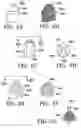 Fig. 16 - DEVICES AND METHODS FOR MAINTAINING COLLATERAL CHANNELS IN TISSUE