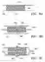 Fig. 20 - DEVICES AND METHODS FOR MAINTAINING COLLATERAL CHANNELS IN TISSUE