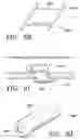 Fig. 22 - DEVICES AND METHODS FOR MAINTAINING COLLATERAL CHANNELS IN TISSUE