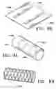 Fig. 23 - DEVICES AND METHODS FOR MAINTAINING COLLATERAL CHANNELS IN TISSUE