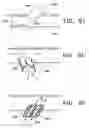 Fig. 26 - DEVICES AND METHODS FOR MAINTAINING COLLATERAL CHANNELS IN TISSUE
