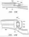Fig. 36 - DEVICES AND METHODS FOR MAINTAINING COLLATERAL CHANNELS IN TISSUE