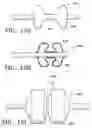 Fig. 37 - DEVICES AND METHODS FOR MAINTAINING COLLATERAL CHANNELS IN TISSUE