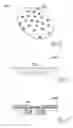Fig. 10 - Implantable medical device minimizing rotation and dislocation