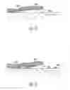 Fig. 23 - Implantable medical device minimizing rotation and dislocation