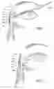 Fig. 03 - Transnasal method and catheter for lacrimal system