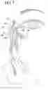 Fig. 05 - Transnasal method and catheter for lacrimal system