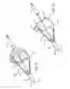 Fig. 05 - Embolic filtering devices