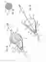 Fig. 07 - Embolic filtering devices