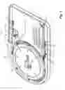 Fig. 02 - Embolic protection system