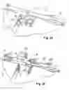 Fig. 12 - Embolic protection system