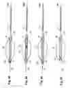 Fig. 22 - Embolic protection system