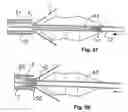 Fig. 24 - Embolic protection system