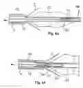 Fig. 26 - Embolic protection system