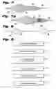 Fig. 04 - Temporary vascular filter guide wire