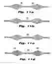 Fig. 06 - Temporary vascular filter guide wire
