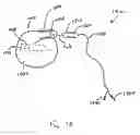 Fig. 10 - Magnetically coupled microstimulators