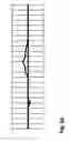 Fig. 18 - Implantable device for cardiac vector determination