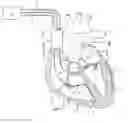 Fig. 01 - Electrical angle gauge