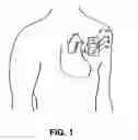 Fig. 02 - Medical device packaging system
