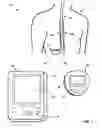 Fig. 02 - Distributed system for neurostimulation therapy programming