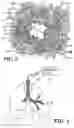 Fig. 03 - APPARATUS FOR TREATING AIRWAYS IN THE LUNG
