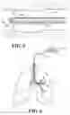 Fig. 04 - APPARATUS FOR TREATING AIRWAYS IN THE LUNG