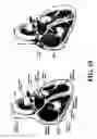 Fig. 11 - Pacemaker/defibrillator lead system