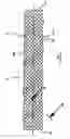 Fig. 01 - Braided stent