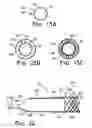Fig. 12 - Over the endoscope introducer for stents