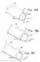 Fig. 15 - Over the endoscope introducer for stents