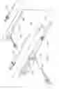 Fig. 09 - Modular stent graft assembly and use thereof