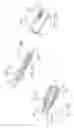 Fig. 10 - Modular stent graft assembly and use thereof