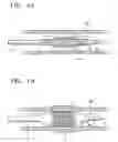 Fig. 02 - Vascular stent which is specially designed for the multiple drug loading and better drug elution