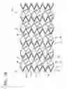 Fig. 05 - Vascular stent which is specially designed for the multiple drug loading and better drug elution
