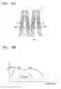 Fig. 10 - Vascular stent which is specially designed for the multiple drug loading and better drug elution