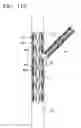 Fig. 16 - Vascular stent which is specially designed for the multiple drug loading and better drug elution