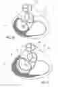 Fig. 03 - Apparatuses and methods for heart valve repair