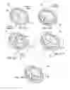 Fig. 05 - Apparatuses and methods for heart valve repair