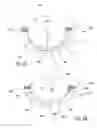 Fig. 06 - Apparatuses and methods for heart valve repair
