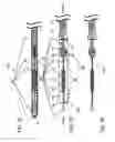 Fig. 16 - Apparatuses and methods for heart valve repair
